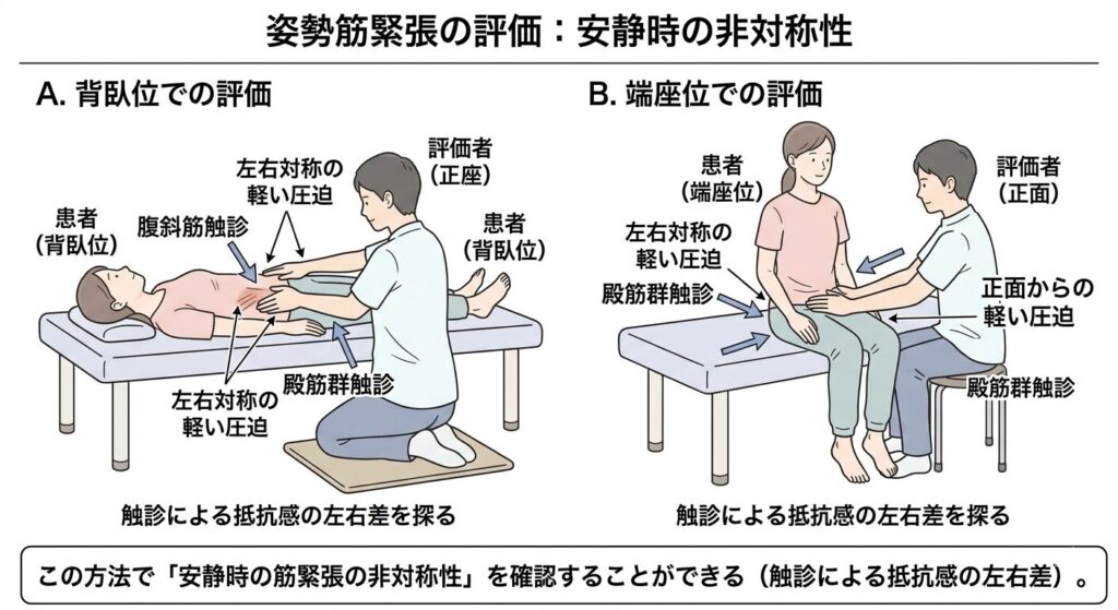 姿勢筋緊張の評価：安静時の非対称性