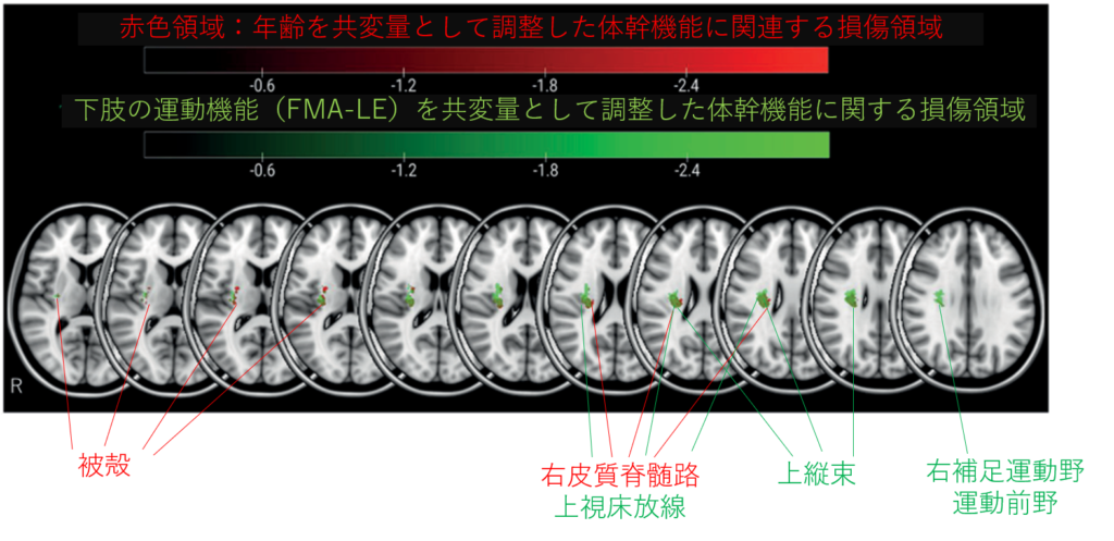 体幹機能と関連する脳領域