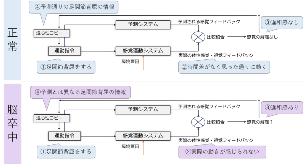 正常と脳卒中のコンパレータモデル